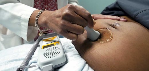 US births in 2022 didnt return to pre-pandemic levels