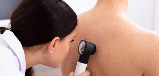 ‘Fantastic’ new technology allows NHS doctors to quickly diagnose skin cancer