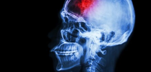 AANS, CNS urge CMS to finalize rules to improve prior authorization