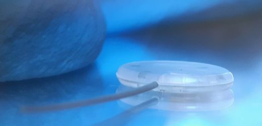 Developing minimally invasive smart glaucoma implants