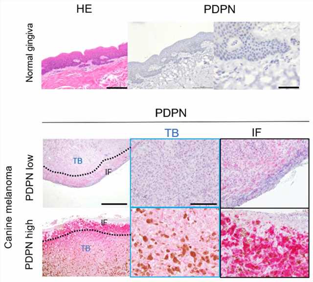 Immobilizing mucosal melanoma: Eliminating a protein could lead to a potential treatment