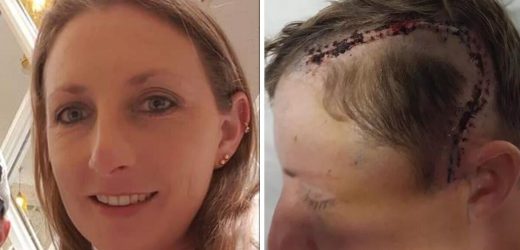 Mum, 41, told she had months to live following an unexpected seizure