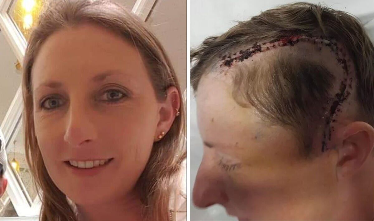 Mum, 41, told she had months to live following an unexpected seizure