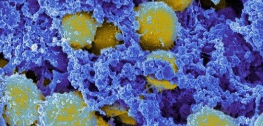 Probiotic combo found to stop bacteria that cause toxic shock syndrome