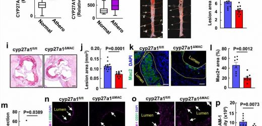Research pinpoints inflammation source behind atherosclerosis