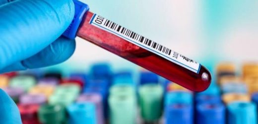 Single-visit sample collection recommended for hepatitis C testing