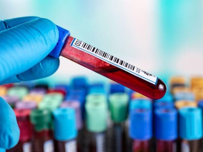 Single-visit sample collection recommended for hepatitis C testing