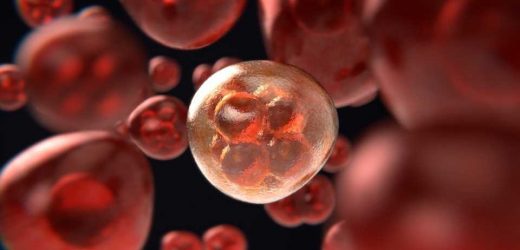 Team reveals specific mechanism for promoting cancer vulnerability to ferroptosis