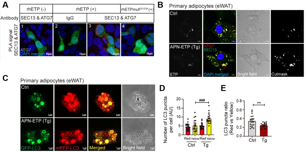 Unraveling the link between obesity, diabetes and endotrophin