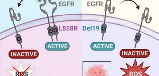 A select group: Study may bring improved therapy to preselected lung cancer patients