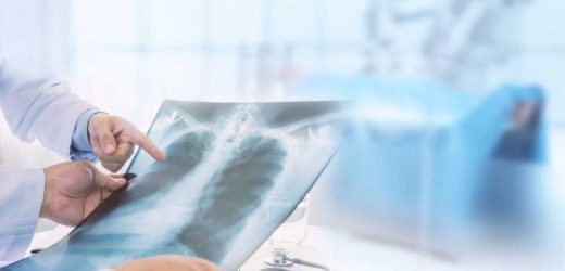 AI-based model indicates chest radiography as a potential biomarker of aging