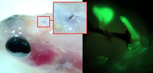 Electrotherapy without surgery using temporary organic electrodes