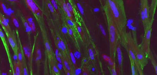 Gene editing system restores dystrophin function in stem cells from patients with Duchenne muscular dystrophy