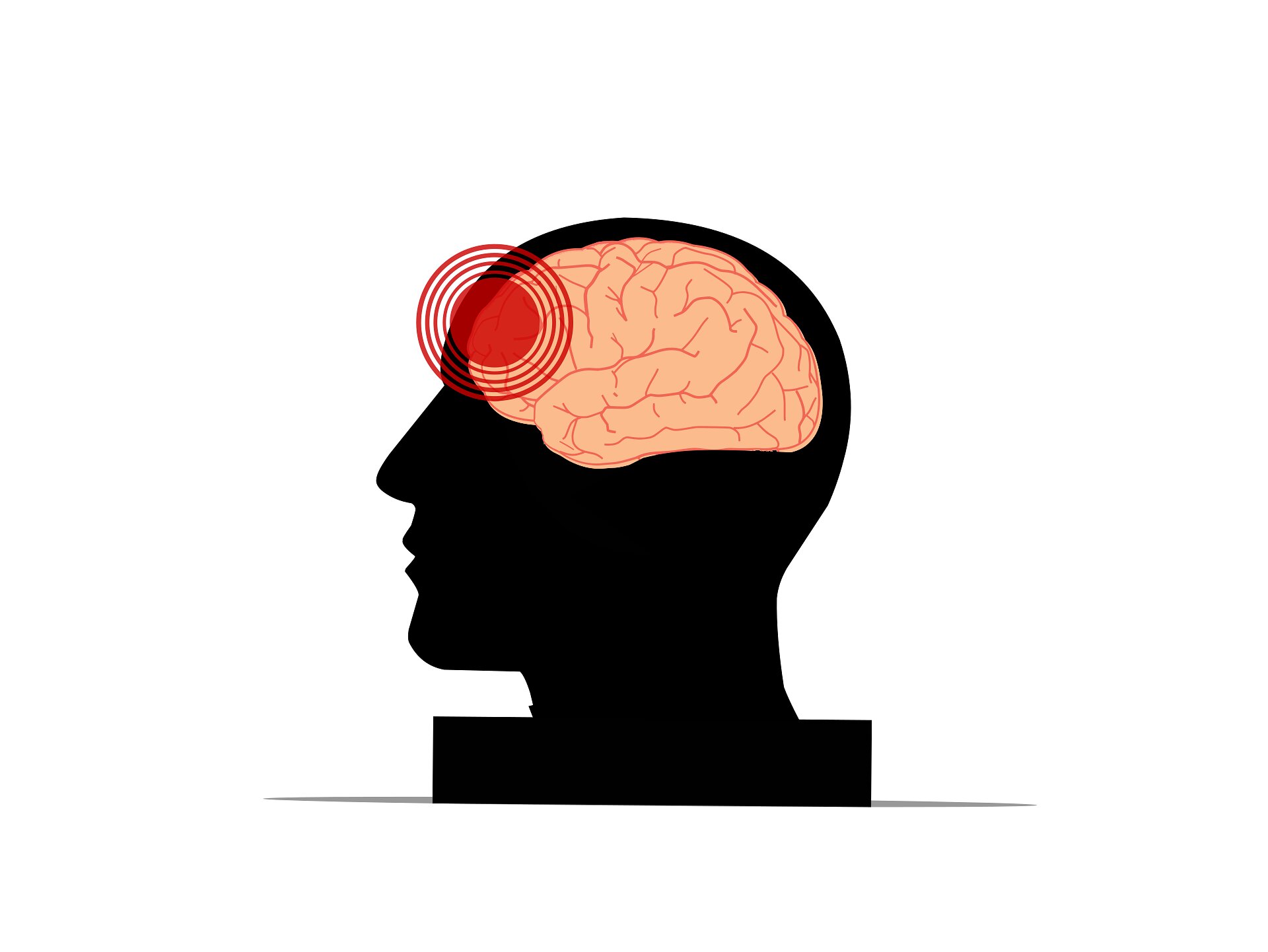 How processing speed affects the benefits of cognitive rehabilitation for individuals with traumatic brain injury