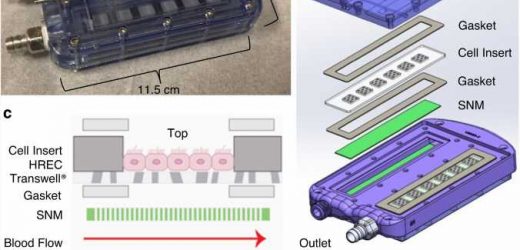 Implantable bioreactor study works toward a bioartificial kidney to free patients from dialysis