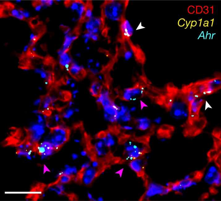 Research finds that molecules in vegetables can help to ease lung infection