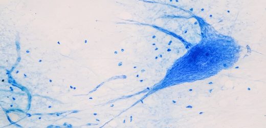 Researchers develop new model to find potential treatment for neuromuscular diseases