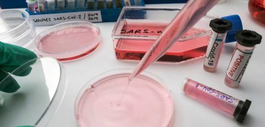 Study explores the role of N6-methyladensoine methylation and COVID-19