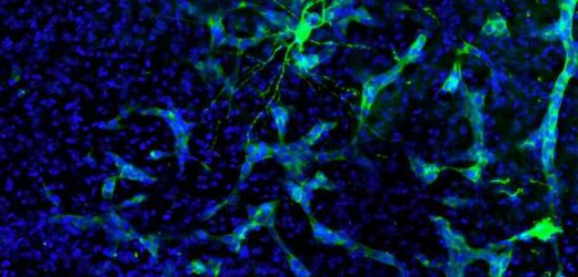 Study finds that brain tumors hack the communication between neurons