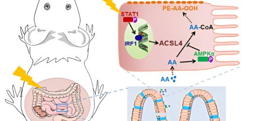Arachidonic acid found to promote the occurrence of radiation-induced intestinal injury