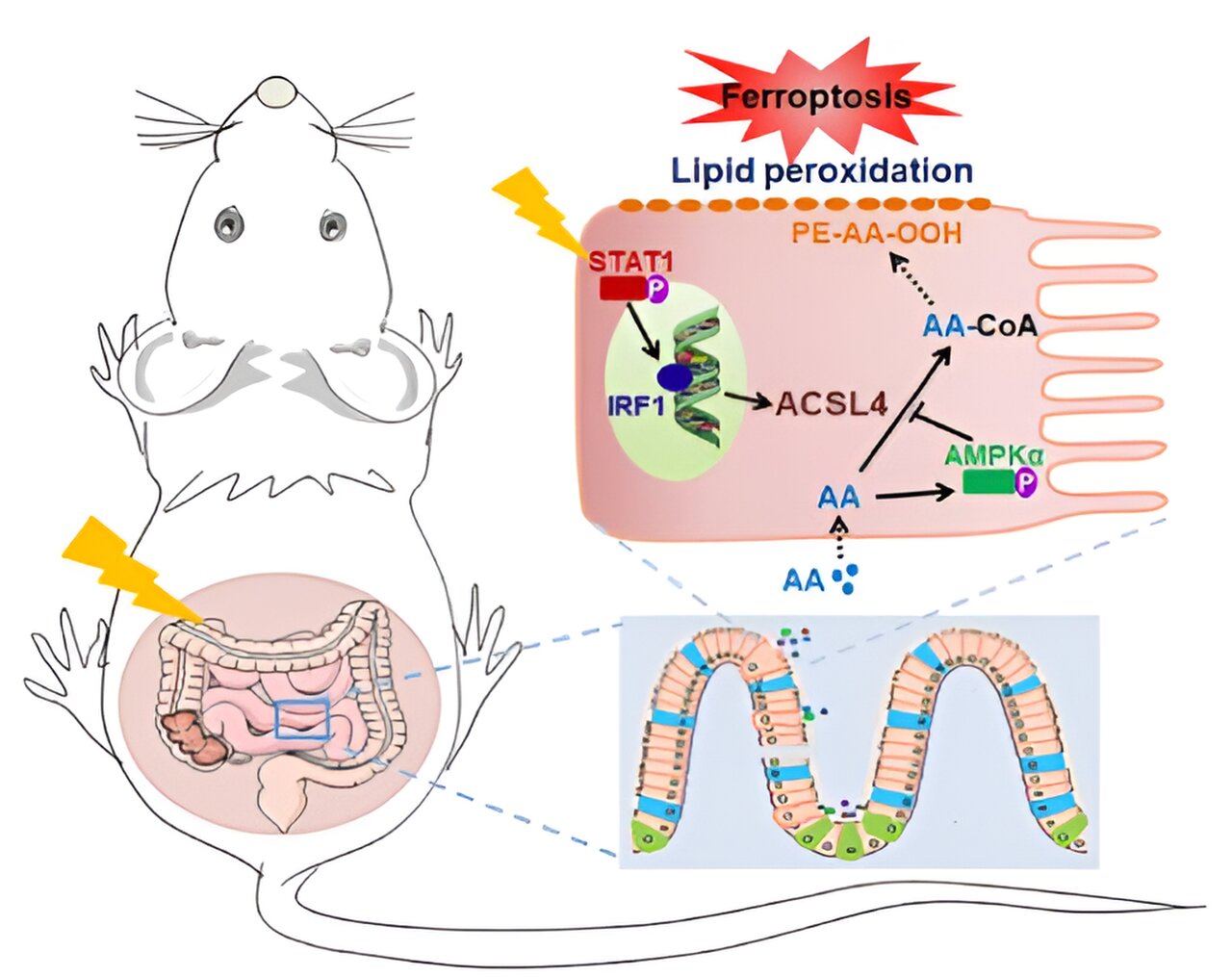 Arachidonic acid found to promote the occurrence of radiation-induced intestinal injury