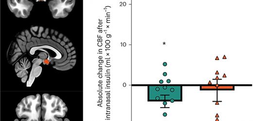 Brain sensitivity to insulin may be modulated by menstrual cycle