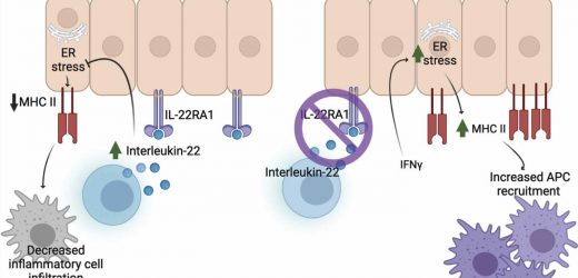 Interleukin-22 study provides better understanding of immune responses in inflammatory bowel and lung disease