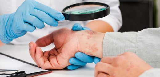 Psoriasis vs. atopic dermatitis: New study reveals surprising inflammatory differences in age-specific groups