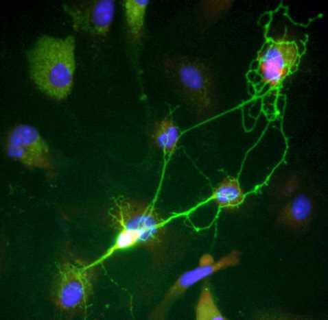 The discovery of a new kind of cell shakes up neuroscience