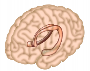 How the hippocampus distinguishes true and false memories