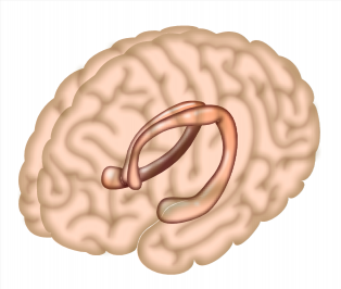 How the hippocampus distinguishes true and false memories