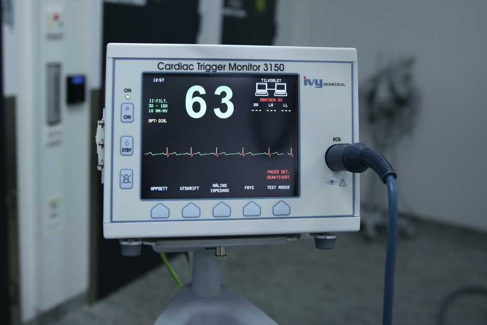 Post-stroke irregular heart rhythms dont predict another stroke, study finds