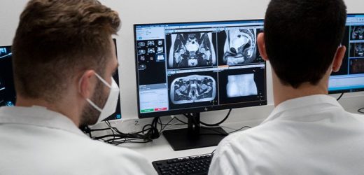 Radiotherapy for prostate cancer: 5 higher doses safe and effective