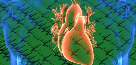 ACC/AHA Issue Updated Atrial Fibrillation Guideline