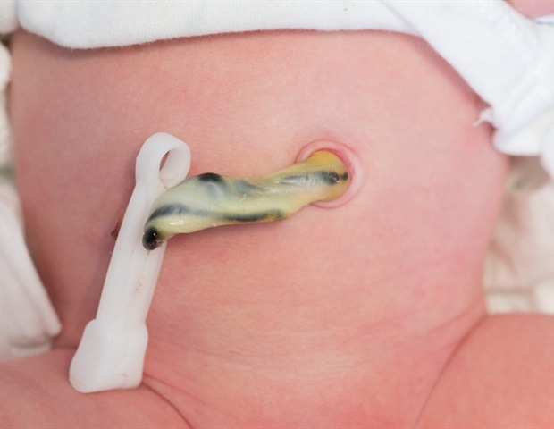 Delaying cord clamping could save lives of premature babies
