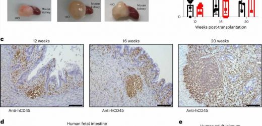 Miniature colons with immune components aid the study of intestinal diseases