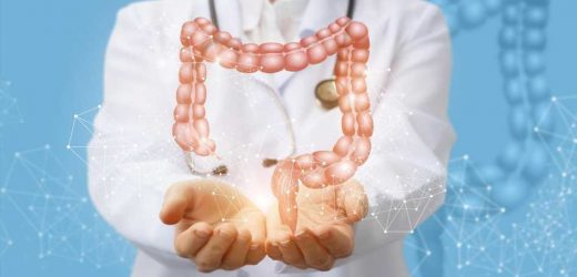 Risk-adapted starting age of CRC screening varies by sex, genetics