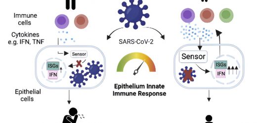 SARS-CoV-2: Alert immune system in the respiratory tract protects children from severe courses of the disease