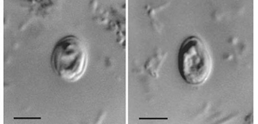 Dietary supplement could protect against Cryptosporidium infection