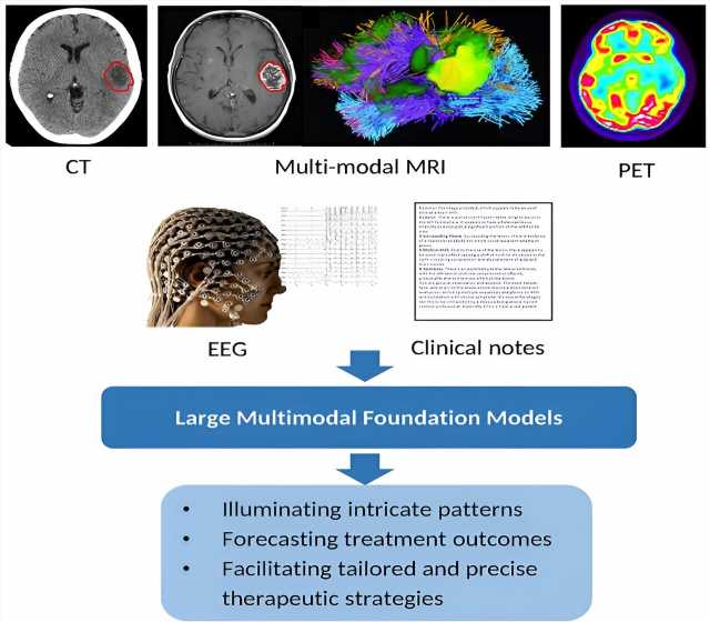 Exploring artificial general intelligence for radiation oncology